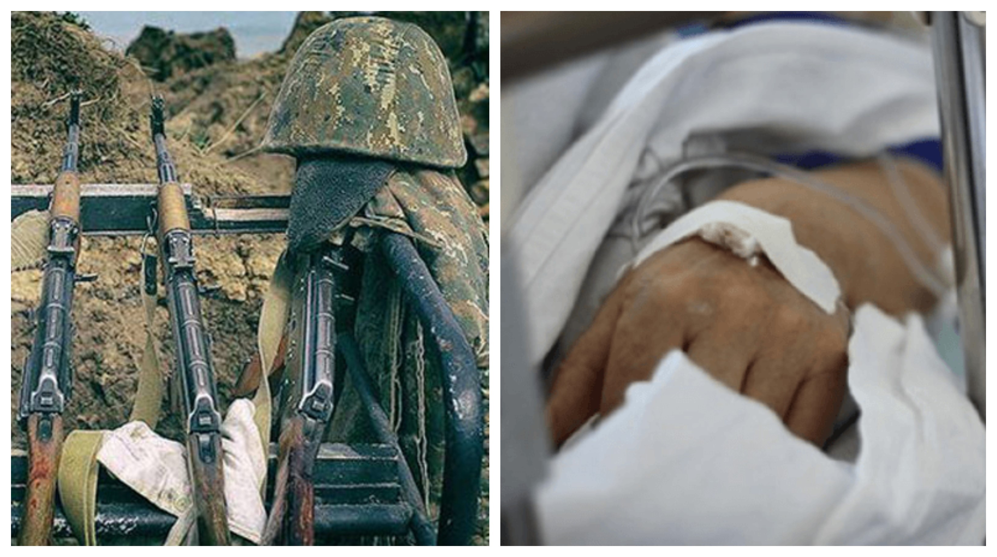 Հրազենային վիրավորում է ստացել ԶՈՒ զինծառայող. վիճակը գնահատվում է ծայրահեղ ծանր