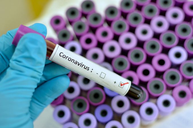  Վրաստանում կորոնավիրուսային վարակի դեպքերի թիվն ավելացել է 6-ով 