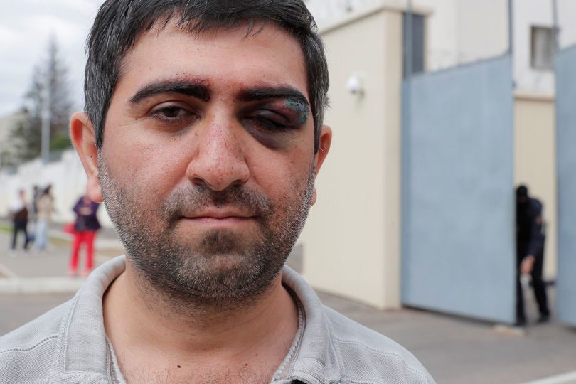 Մինսկում ուժայինները ծեծել են ՀՀ քաղաքացու (տեսանյութ)