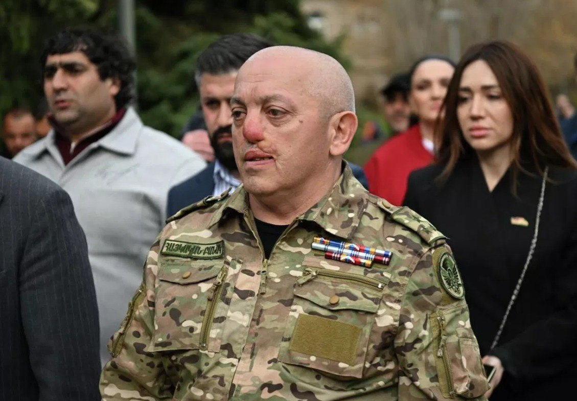 Արթուր Ավանեսյանի (Կանդազ) կալանքը փոխարինվեց տնային կալանքով