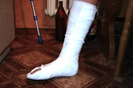 162 դպրոցում կոտրել են աշակերտուհու ոտքը