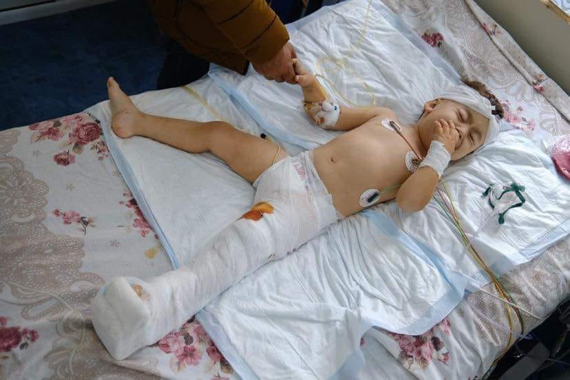 2 տարեկան Արծվիկը վիրավորվել է հարազատ Մարտունի քաղաքում ծանր ռմբակոծությունից հետո