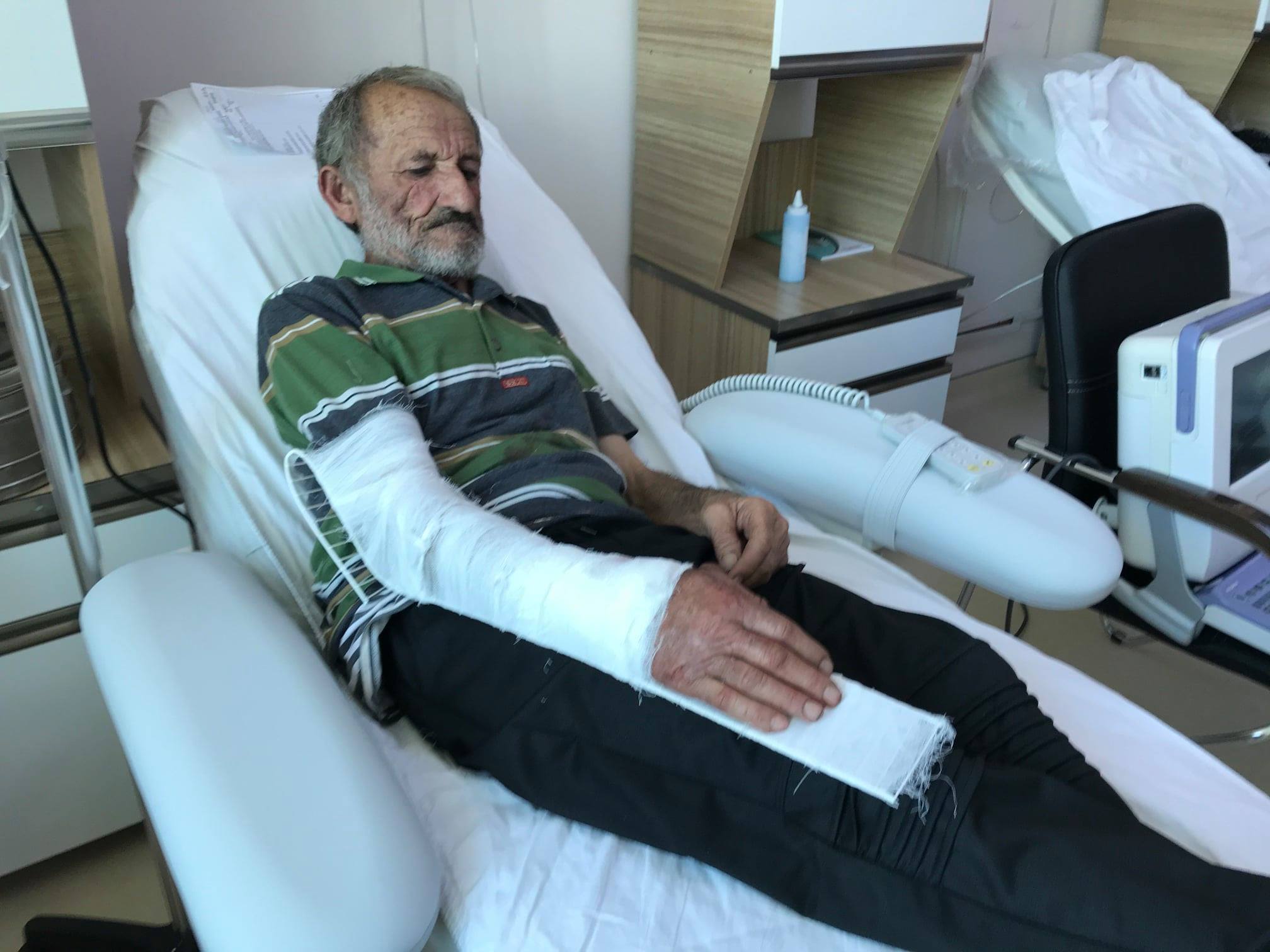 Արցախի ՄԻՊ-ը հրապարակել է ադրբեջանական հրետակոծությունից վիրավորված քաղաքացիների լուսանկարներ