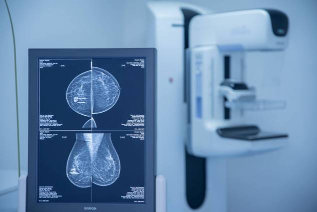 50-69 տարեկան կանայք հնարավորություն ունեն անցնելու կրծքագեղձի մամոգրաֆիկ անվճար հետազոտություն նաև արդեն Ալավերդիում