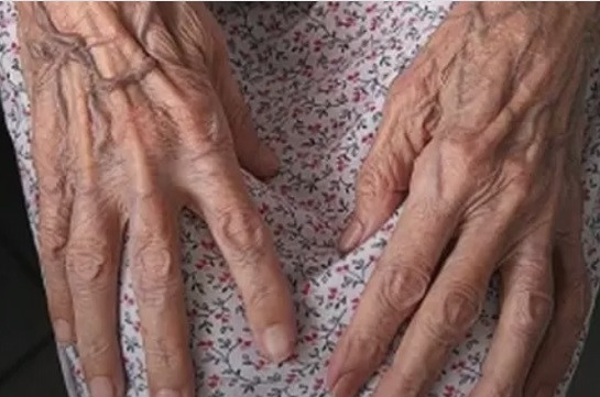 Մահացել է Հայաստանի ամենատարեց կինը՝ 104-ամյա Արժո Չիլինգարյանը