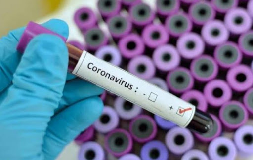 Правительство Армении ведет переговоры с владельцами гостиниц для размещения там пациентов с легкой формой коронавируса 
