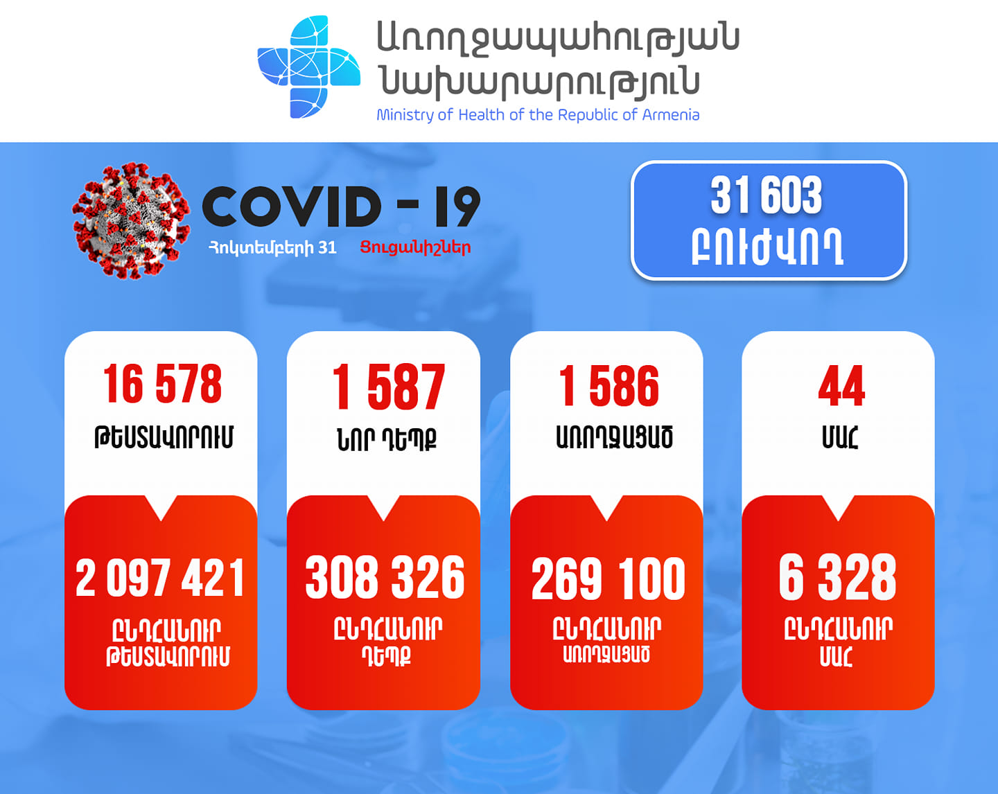Հաստատվել է կորոնավիրուսի 1587 նոր դեպք, մահացել է 44 քաղաքացի
