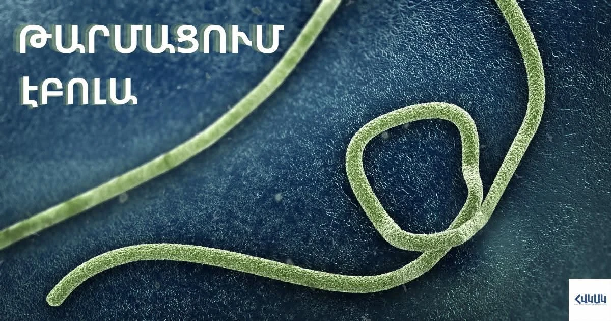 Էբոլայի դեպքեր՝ Աֆրիկայի երեք երկրում․ Հայաստանի համար ներմուծման ռիսկը ցածր է գնահատվում